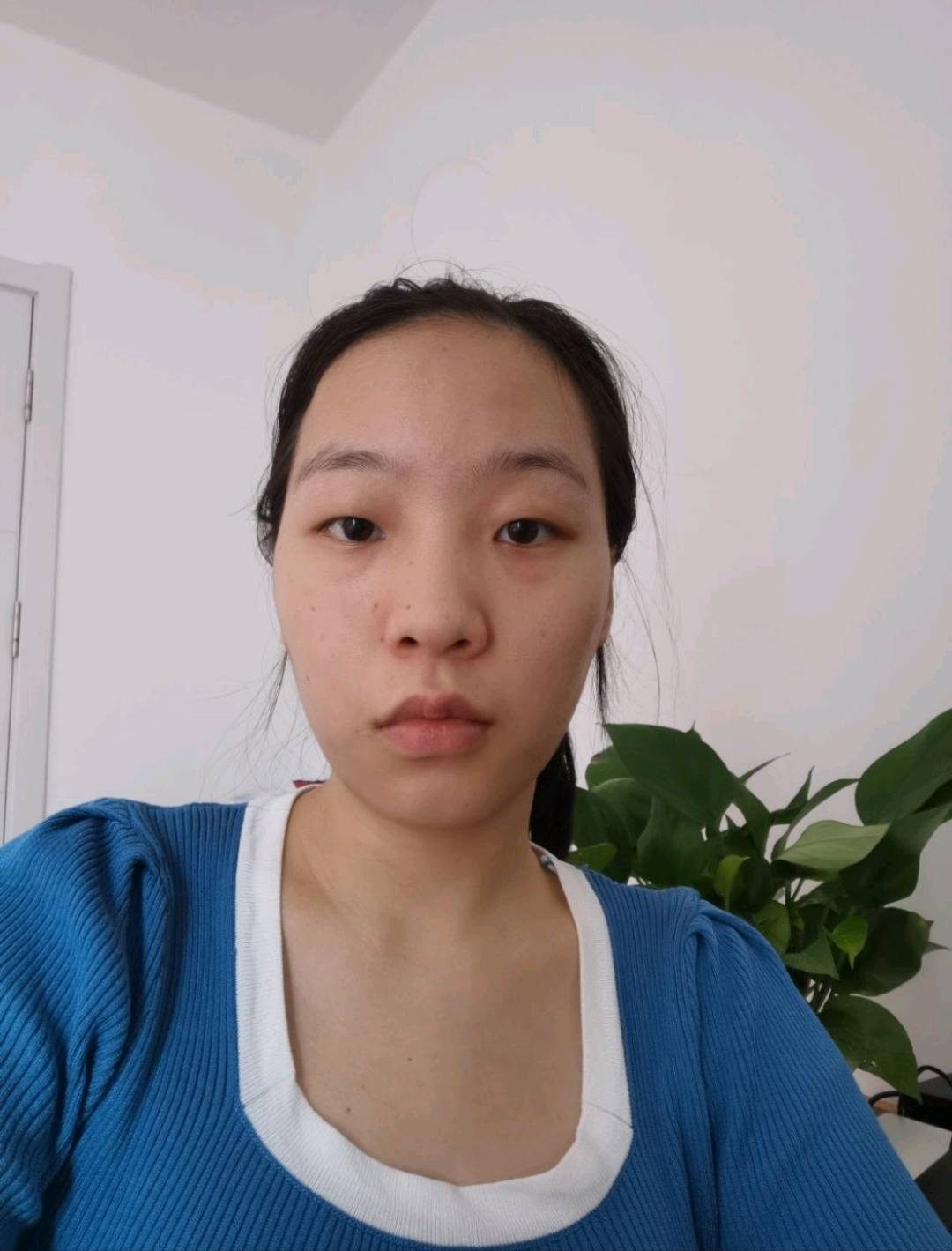 大蒜头